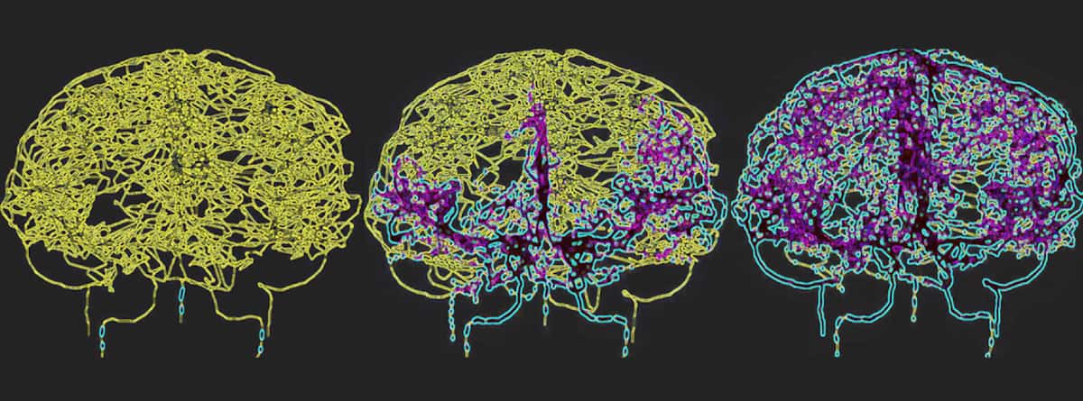 Modelling blood flow in the brain