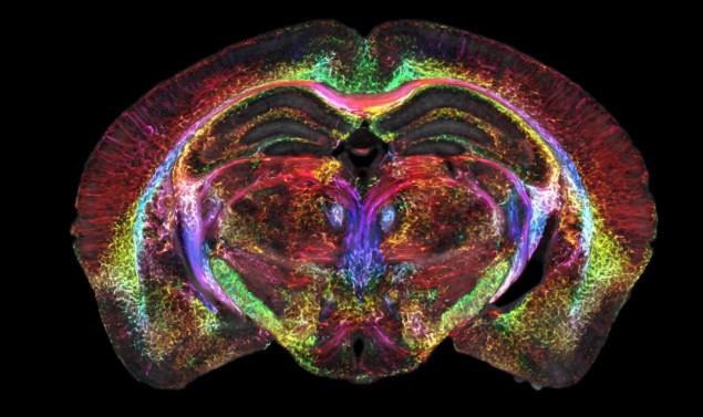 MR imaging of the mouse brain MR imaging of the mouse brain