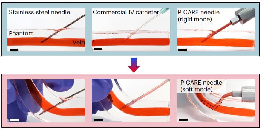 Comparison of intravenous access devices