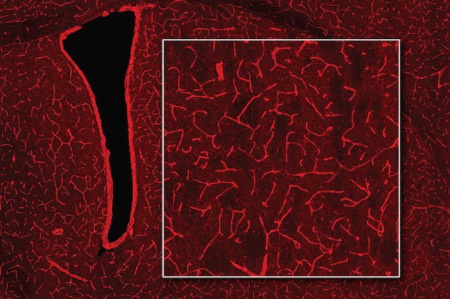 Bioluminescence Imaging An image of blood vessels in the brain resembling a complex embroidery of bright-red threads on a black background