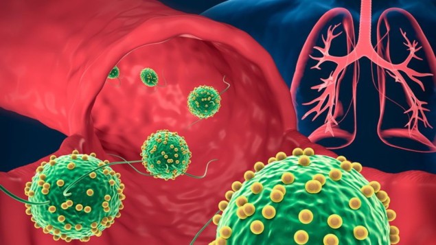 Microrobots deliver antibiotics into the lungs Microrobots deliver antibiotics into the lungs